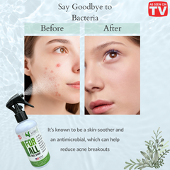 All in One HOCL Skin Spray