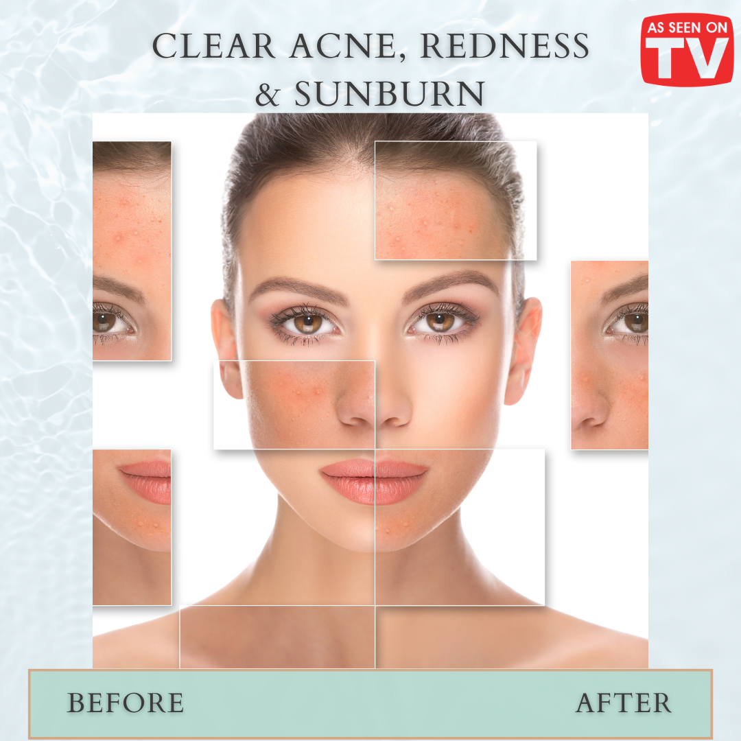 All in One HOCL Skin Spray