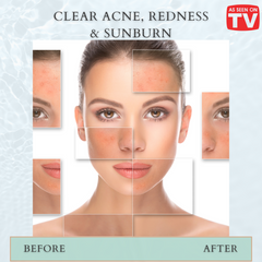 All in One HOCL Skin Spray